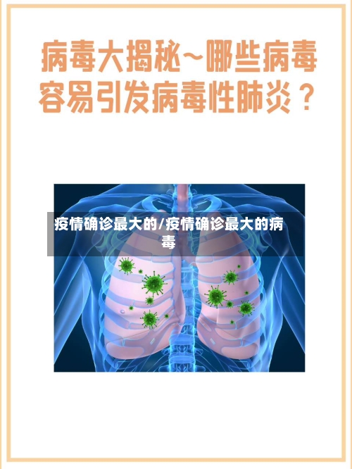 疫情确诊最大的/疫情确诊最大的病毒