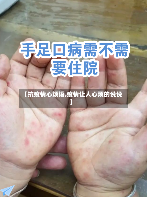 【抗疫情心烦语,疫情让人心烦的说说】