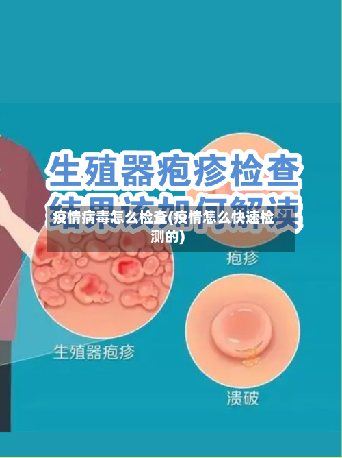 疫情病毒怎么检查(疫情怎么快速检测的)-第2张图片