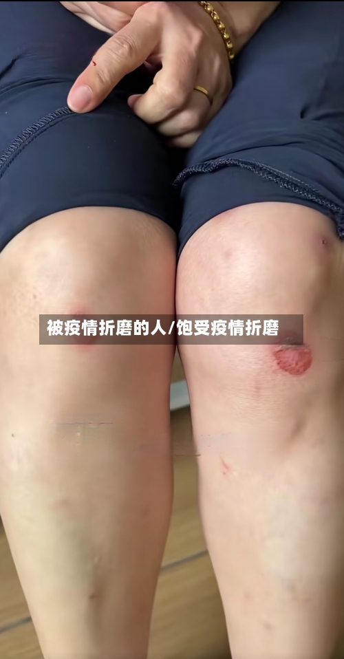 被疫情折磨的人/饱受疫情折磨-第2张图片