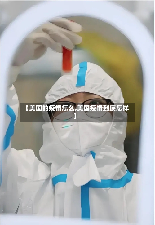 【美国的疫情怎么,美国疫情到底怎样】-第2张图片