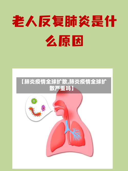 【肺炎疫情全球扩散,肺炎疫情全球扩散严重吗】-第2张图片