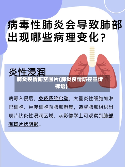 肺炎疫情防空图片(肺炎疫情防控宣传标语)-第2张图片