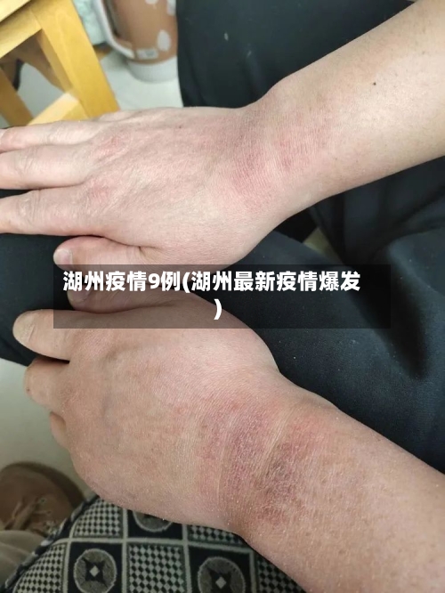 湖州疫情9例(湖州最新疫情爆发)