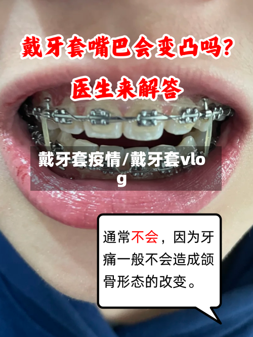 戴牙套疫情/戴牙套vlog-第2张图片